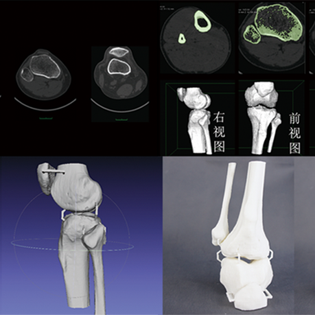 CT數(shù)據(jù)三維重建骨骼模型，骨骼模型精細(xì)化建模修復(fù)，骨骼模型3D打印快速成型