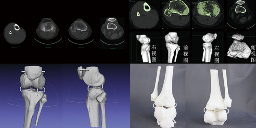 CT數(shù)據(jù)三維重建骨骼模型，骨骼模型精細(xì)化建模修復(fù)，骨骼模型3D打印快速成型