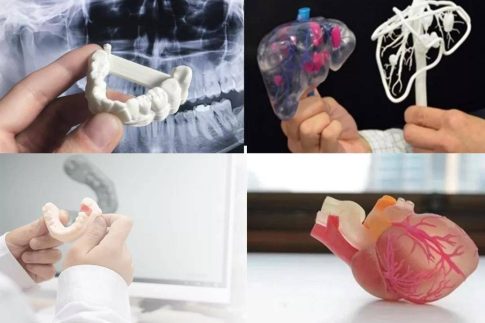 CT數(shù)據(jù)三維重建，醫(yī)學(xué)3D打印技術(shù)在骨科中的具體應(yīng)用