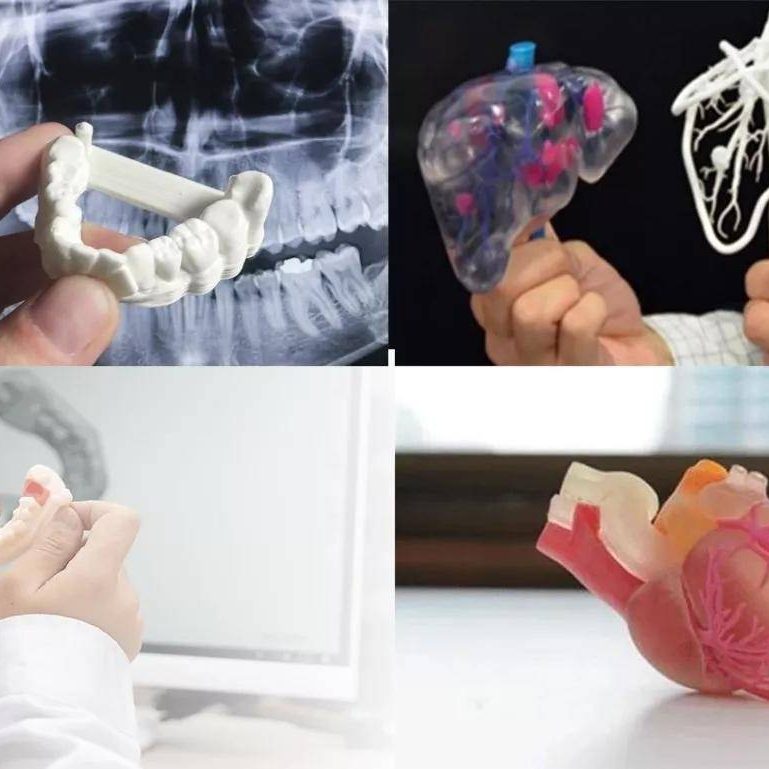 CT數(shù)據(jù)三維重建，醫(yī)學(xué)3D打印技術(shù)在骨科中的具體應(yīng)用